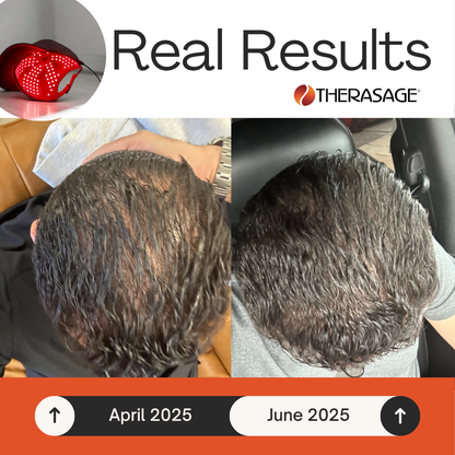 Therasage TheraCap Red &amp; Near-Infrared LED Scalp Wellness Cap