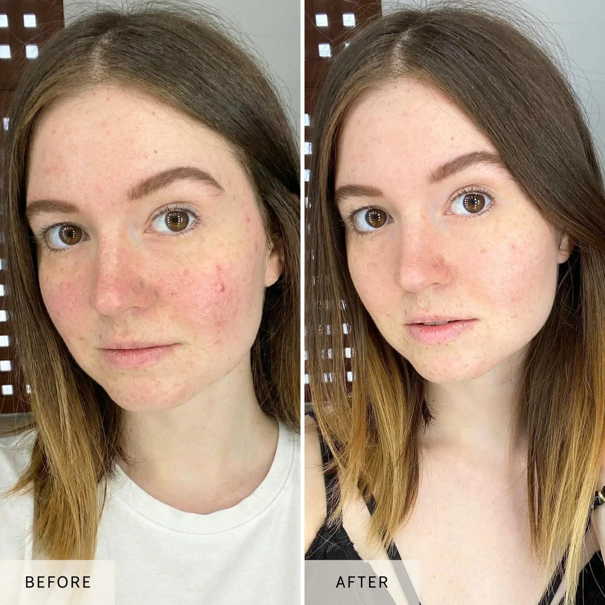 Nicebeam 4-Wavelength LED + Laser Light Therapy Face Mask